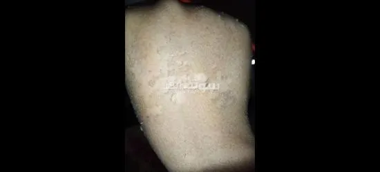مقشرات ومرطبات وتفتيح - 3