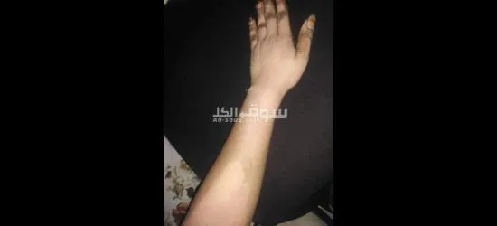 مقشرات ومرطبات وتفتيح - 4