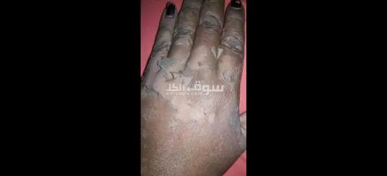 مقشرات ومرطبات وتفتيح - 6